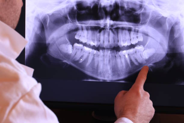 Best Emergency Gum Treatment in Shokan, NY