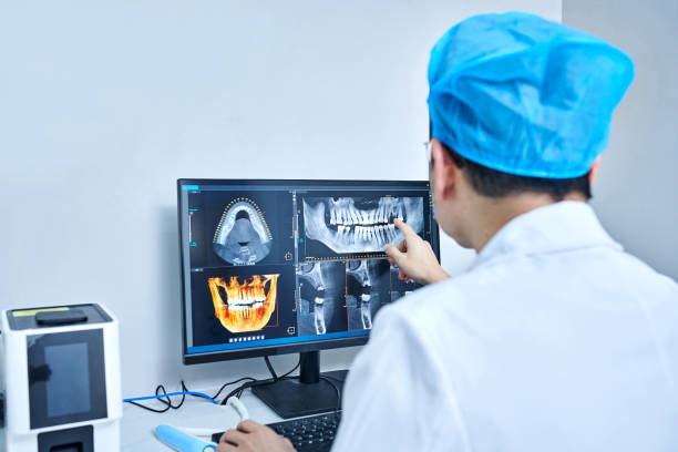 Best Emergency Wisdom Teeth Removal in Shokan, NY